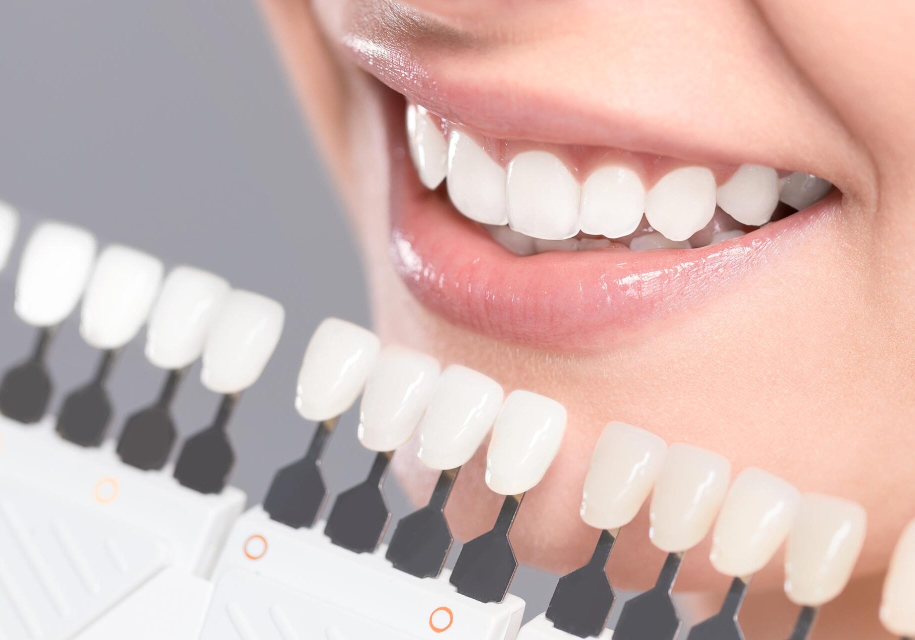 cosmetic dentistry services cascade